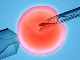 Tüp Bebekte Embriyo Genetik İncelemesi; PGT